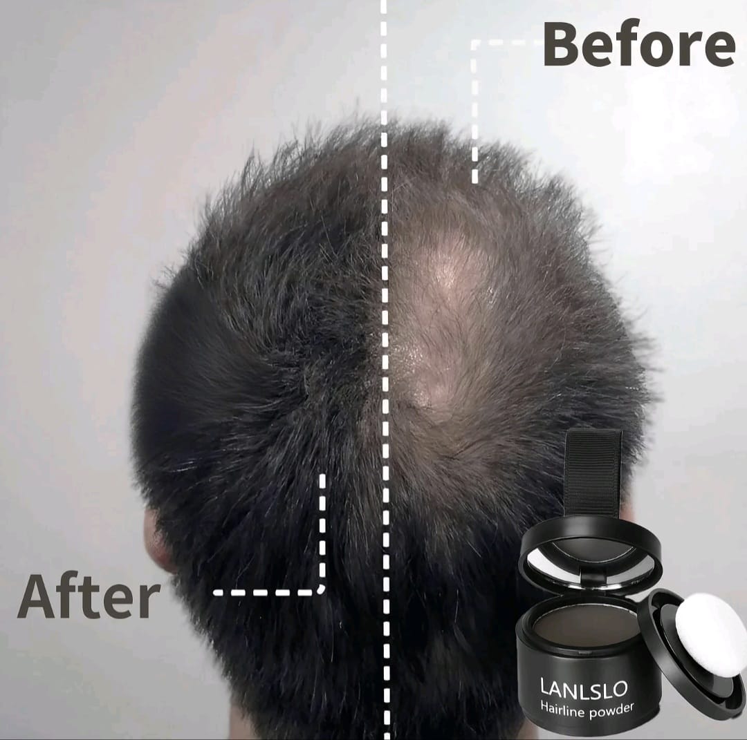 Hasil before & after LANISLO